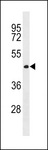 CWC27 Antibody - CWC27 Antibody western blot of MDA-MB453 cell line lysates (35 ug/lane). The CWC27 antibody detected the CWC27 protein (arrow).