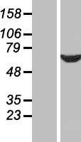 CWC27 Protein - Western validation with an anti-DDK antibody * L: Control HEK293 lysate R: Over-expression lysate