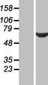 CWC27 Protein - Western validation with an anti-DDK antibody * L: Control HEK293 lysate R: Over-expression lysate