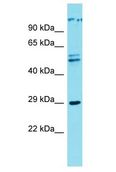 CWF19L1 Antibody - CWF19L1 antibody Western Blot of U937. Antibody dilution: 1 ug/ml.  This image was taken for the unconjugated form of this product. Other forms have not been tested.