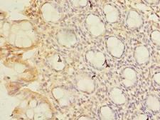 CWF19L1 Antibody - Immunohistochemistry of paraffin-embedded human rectum tissue using antibody at dilution of 1:100.