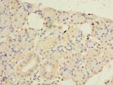 CWF19L1 Antibody - Immunohistochemistry of paraffin-embedded human pancreatic tissue using antibody at dilution of 1:100.