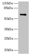 CWF19L1 Antibody - Western blot All lanes: CWF19L1 antibody at 4µg/ml + Raji whole cell lysate Secondary Goat polyclonal to rabbit IgG at 1/10000 dilution Predicted band size: 61, 28, 46 kDa Observed band size: 61 kDa