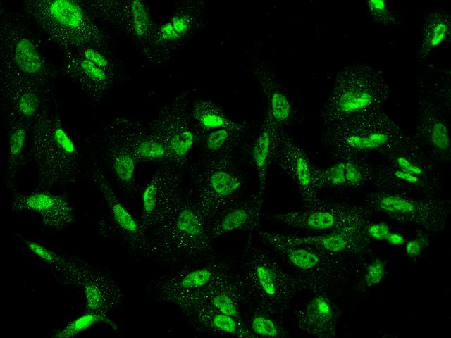 CWF19L1 Antibody - Immunofluorescence staining of CWF19L1 in U251MG cells. Cells were fixed with 4% PFA, permeabilzed with 0.1% Triton X-100 in PBS, blocked with 10% serum, and incubated with rabbit anti-Human CWF19L1 polyclonal antibody (dilution ratio 1:200) at 4°C overnight. Then cells were stained with the Alexa Fluor 488-conjugated Goat Anti-rabbit IgG secondary antibody (green). Positive staining was localized to Nucleus.