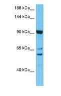 CWF19L2 Antibody - Western blot of CWF19L2 Antibody with human RPMI-8226 Whole Cell lysate.  This image was taken for the unconjugated form of this product. Other forms have not been tested.