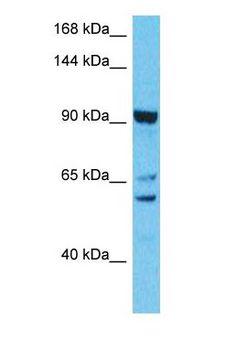 CWF19L2 Antibody - Western blot of CWF19L2 Antibody with human RPMI-8226 Whole Cell lysate.  This image was taken for the unconjugated form of this product. Other forms have not been tested.