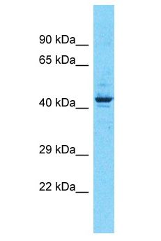 CX3CL1 / Fractalkine Antibody - CX3CL1 / Fractalkine antibody Western Blot of OVCAR-3. Antibody dilution: 3 ug/ml.  This image was taken for the unconjugated form of this product. Other forms have not been tested.
