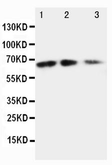CX3CL1 / Fractalkine Antibody - WB of CX3CL1 / Fractalkine antibody. All lanes: Anti-Fractalkine at 0.5ug/ml. Lane 1: Recombinant Mouse Fractalkin Protein 10ng. Lane 2: Recombinant Mouse Fractalkin Protein 5ng. Lane 3: Recombinant Mouse Fractalkin Protein 2.5ng. Predicted bind size: 65KD. Observed bind size:65 KD.