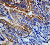 CX3CL1 / Fractalkine Antibody - CX3CL1 / Fractalkine antibody. IHC(P): Rat Intestine Tissue.