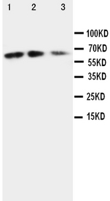 CX3CL1 / Fractalkine Antibody - Anti-CX3CL1 antibody, Western blotting Lane 1: Recombinant Mouse Fractalkin Protein 10ng Lane 2: Recombinant Mouse Fractalkin Protein 5ng Lane 3: Recombinant Mouse Fractalkin Protein 2. 5ng