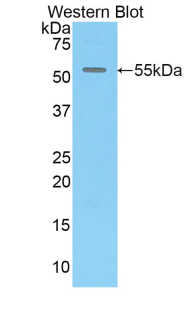 CX3CL1 / Fractalkine Antibody - Western blot of recombinant CX3CL1 / Fractalkine.  This image was taken for the unconjugated form of this product. Other forms have not been tested.