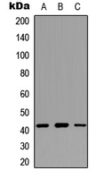 CX3CL1 / Fractalkine Antibody - Western blot analysis of Fractalkine expression in MCF7 (A); NIH3T3 (B); PC12 (C) whole cell lysates.