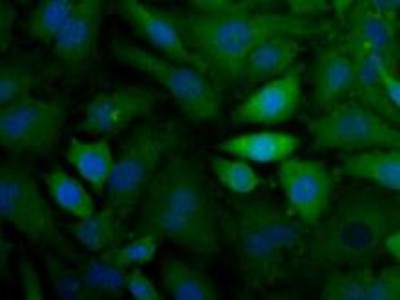 CX3CL1 / Fractalkine Antibody - Immunocytochemistry/Immunofluorescence: CX3CL1 Antibody - Analysis of CX3CL (green) in HeLa cells.  This image was taken for the unconjugated form of this product. Other forms have not been tested.