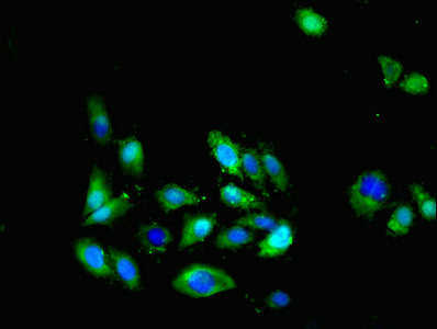 CX3CL1 / Fractalkine Antibody - Immunofluorescent analysis of Hela cells using CX3CL1 Antibody at dilution of 1:100 and Alexa Fluor 488-congugated AffiniPure Goat Anti-Rabbit IgG(H+L)