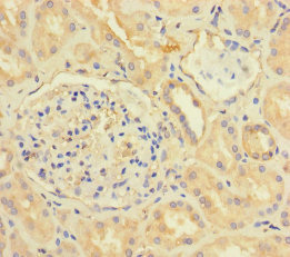 CX3CL1 / Fractalkine Antibody - Immunohistochemistry of paraffin-embedded human kidney tissue using CX3CL1 Antibody at dilution of 1:100