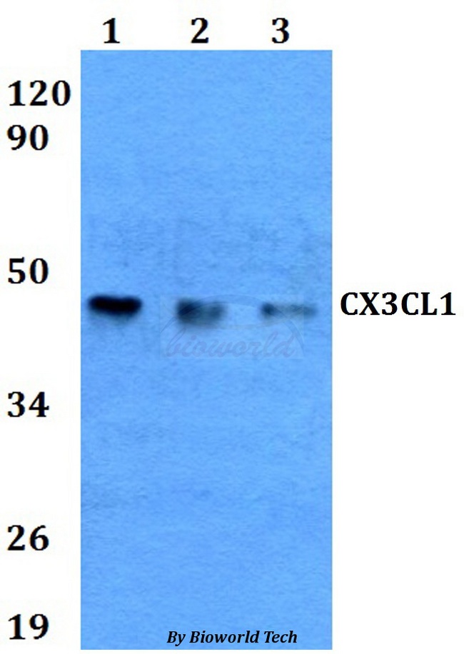 CX3CL1 / Fractalkine Antibody - Western blot of CX3CL1 antibody at 1:500 dilution. Lane 1: MCF-7 whole cell lysate. Lane 2: NIH-3T3 whole cell lysate. Lane 3: PC12 whole cell lysate.