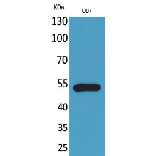 CX3CR1 Antibody - Western blot of Fractalkine Receptor antibody