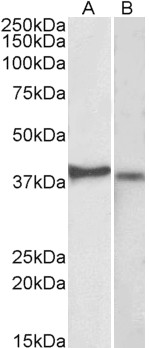 CX3CR1 Antibody - Antibody (2µg/ml) staining of Kelly (A) and U251-MG (B) lysates (35µg protein in RIPA buffer). Primary incubation was 1 hour. Detected by chemiluminescence.