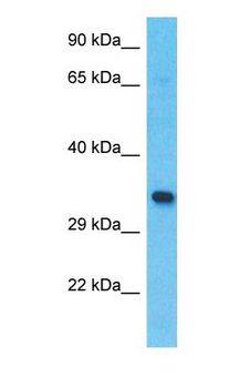 CX3CR1 Antibody - Western blot of CX3CR1 Antibody with human 721_B Whole Cell lysate.  This image was taken for the unconjugated form of this product. Other forms have not been tested.