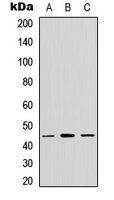 CX3CR1 Antibody - Western blot analysis of GPR13 expression in MCF7 (A); NS-1 (B); PC12 (C) whole cell lysates.