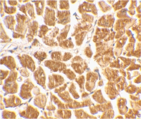 CX3CR1 Antibody - IHC of human heart tissue using CX3CR1 antibody at 2 ug/ml.