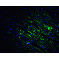 CX3CR1 Antibody - Immunofluorescence of CX3CR1 in rat heart tissue with CX3CR1 antibody at 20 µg/ml.Green: CX3CR1 Antibody  Blue: DAPI staining