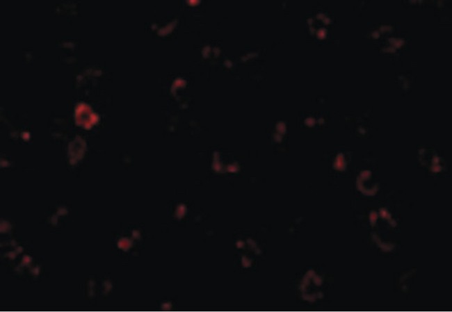 CX3CR1 Antibody - Immunofluorescence of CX3CR1 in THP1 cells with CX3CR1 antibody at 20 ug/ml.