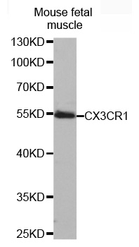 CX3CR1 Antibody - Western blot analysis of extracts of mouse fetal muscle tissue lysate , using CX3CR1 antibody.