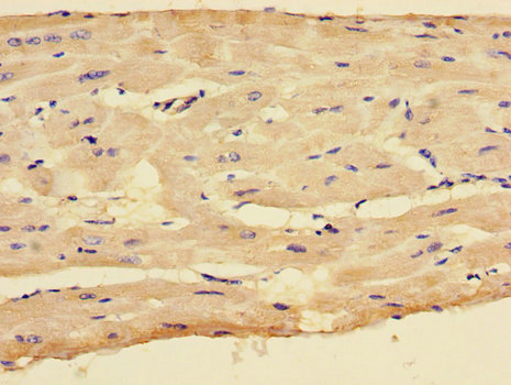 CX3CR1 Antibody - Immunohistochemistry of paraffin-embedded human heart tissue using CX3CR1 Antibody at dilution of 1:100
