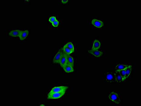 CX3CR1 Antibody - Immunofluorescent analysis of HepG2 cells using CX3CR1 Antibody at a dilution of 1:100 and Alexa Fluor 488-congugated AffiniPure Goat Anti-Rabbit IgG(H+L)