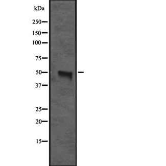 CX3CR1 Antibody - Western blot analysis of CX3CR1 expression in human spleen lysate. The lane on the left is treated with the antigen-specific peptide.