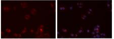 CX3CR1 Antibody - Staining HeLa cells by IF/ICC. The samples were fixed with PFA and permeabilized in 0.1% Triton X-100, then blocked in 10% serum for 45 min at 25°C. The primary antibody was diluted at 1:200 and incubated with the sample for 1 hour at 37°C. An Alexa Fluor 594 conjugated goat anti-rabbit IgG (H+L) antibody, diluted at 1/600 was used as secondary antibody.