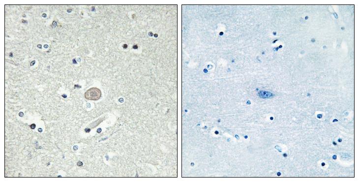 CX3CR1 Antibody - Peptide - + Immunohistochemistry analysis of paraffin-embedded human brain tissue, using CX3CR1 antibody.