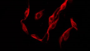 CXADR Antibody - Staining HepG2 cells by IF/ICC. The samples were fixed with PFA and permeabilized in 0.1% Triton X-100, then blocked in 10% serum for 45 min at 25°C. The primary antibody was diluted at 1:200 and incubated with the sample for 1 hour at 37°C. An Alexa Fluor 594 conjugated goat anti-rabbit IgG (H+L) Ab, diluted at 1/600, was used as the secondary antibody.