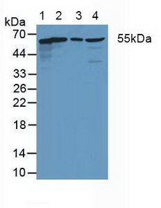 CXADR Antibody - Western Blot; Sample: Lane1: Human Hela Cells; Lane2: Rat Heart Tissue; Lane3: Rat Intestine Tissue; Lane4: Rat Brain Tissue.