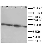 CXADR Antibody - WB of CXADR antibody. Lane 1: Rat Pancreas Tissue Lysate. Lane 2: Rat Brain Tissue Lysate. Lane 3: Rat Heart Tissue Lysate. Lane 4: HELA Cell Lysate. Lane 5: 293T Cell Lysate. Lane 6: COLO320 Cell Lysate.