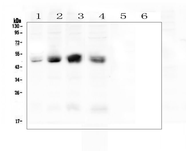 CXADR Antibody - Western blot analysis of Coxsackie Adenovirus Receptor using anti-Coxsackie Adenovirus Receptor antibody. Electrophoresis was performed on a 5-20% SDS-PAGE gel at 70V (Stacking gel) / 90V (Resolving gel) for 2-3 hours. The sample well of each lane was loaded with 50ug of sample under reducing conditions. Lane 1: human A431 whole cell lysates, Lane 2: human Hela whole cell lysates, Lane 3: human HepG2 whole cell lysates, Lane 4: human Caco-2 whole cell lysates, Lane 5: human U-937whole cell lysates(negative), Lane 6: human THP-1whole cell lysates(negative). After Electrophoresis, proteins were transferred to a Nitrocellulose membrane at 150mA for 50-90 minutes. Blocked the membrane with 5% Non-fat Milk/ TBS for 1.5 hour at RT. The membrane was incubated with rabbit anti-Coxsackie Adenovirus Receptor antigen affinity purified polyclonal antibody at 0.5 µg/mL overnight at 4°C, then washed with TBS-0.1% Tween 3 times with 5 minutes each and probed with a goat anti-rabbit IgG-HRP secondary antibody at a dilution of 1:10000 for 1.5 hour at RT. The signal is developed using an Enhanced Chemiluminescent detection (ECL) kit with Tanon 5200 system. A specific band was detected for Coxsackie Adenovirus Receptor at approximately 50KD. The expected band size for Coxsackie Adenovirus Receptor is at 40KD.