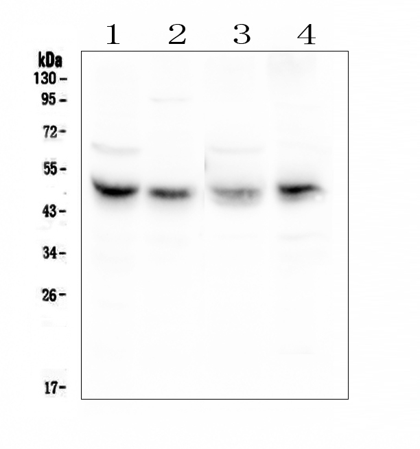 CXADR Antibody - Western blot analysis of Coxsackie Adenovirus Receptor using anti-Coxsackie Adenovirus Receptor antibody. Electrophoresis was performed on a 5-20% SDS-PAGE gel at 70V (Stacking gel) / 90V (Resolving gel) for 2-3 hours. The sample well of each lane was loaded with 50ug of sample under reducing conditions. Lane 1: rat liver tissue lysate, Lane 2: rat heart tissue lysates, Lane 3: mouse liver tissue lysates, Lane 4: mouse HEPA1-6 whole cell lysates. After Electrophoresis, proteins were transferred to a Nitrocellulose membrane at 150mA for 50-90 minutes. Blocked the membrane with 5% Non-fat Milk/ TBS for 1.5 hour at RT. The membrane was incubated with rabbit anti-Coxsackie Adenovirus Receptor antigen affinity purified polyclonal antibody at 0.5 µg/mL overnight at 4°C, then washed with TBS-0.1% Tween 3 times with 5 minutes each and probed with a goat anti-rabbit IgG-HRP secondary antibody at a dilution of 1:10000 for 1.5 hour at RT. The signal is developed using an Enhanced Chemiluminescent detection (ECL) kit with Tanon 5200 system. A specific band was detected for Coxsackie Adenovirus Receptor at approximately 50KD. The expected band size for Coxsackie Adenovirus Receptor is at 40KD.