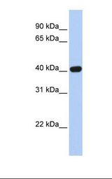 CXADR Antibody - Fetal brain lysate. Antibody concentration: 1.0 ug/ml. Gel concentration: 12%.  This image was taken for the unconjugated form of this product. Other forms have not been tested.