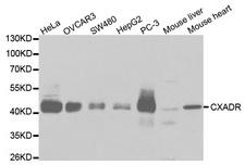 CXADR Antibody - Western blot analysis of extracts of various cell lines.