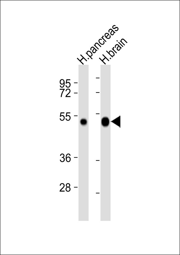 CXADR Antibody - All lanes : Anti-CXADR Antibody at 1:1000 dilution Lane 1: human pancreas lysates Lane 2: human brain lysates Lysates/proteins at 20 ug per lane. Secondary Goat Anti-Rabbit IgG, (H+L),Peroxidase conjugated at 1/10000 dilution Predicted band size : 40 kDa Blocking/Dilution buffer: 5% NFDM/TBST.