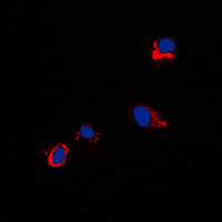 CXADR Antibody - Immunofluorescent analysis of CXADR staining in NIH3T3 cells. Formalin-fixed cells were permeabilized with 0.1% Triton X-100 in TBS for 5-10 minutes and blocked with 3% BSA-PBS for 30 minutes at room temperature. Cells were probed with the primary antibody in 3% BSA-PBS and incubated overnight at 4 C in a humidified chamber. Cells were washed with PBST and incubated with a DyLight 594-conjugated secondary antibody (red) in PBS at room temperature in the dark. DAPI was used to stain the cell nuclei (blue).
