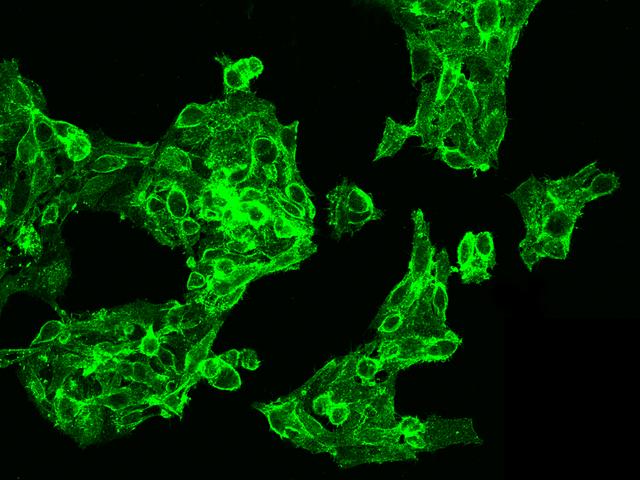 CXADR Antibody - Immunofluorescence staining of CXADR in HepG2 cells. Cells were fixed with 4% PFA, blocked with 10% serum, and incubated with rabbit anti-Human CXADR polyclonal antibody (dilution ratio 1:1000) at 4°C overnight. Then cells were stained with the Alexa Fluor 488-conjugated Goat Anti-rabbit IgG secondary antibody (green). Positive staining was localized to cell membrane.
