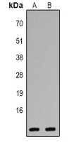 CXCL1 / GRO Alpha Antibody - Western blot analysis of CXCL1 expression in Jurkat (A); HeLa (B) whole cell lysates.