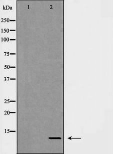 CXCL1 / GRO Alpha Antibody - Western blot analysis of GRO alphaexpression in Jurkat cells lysate. The lane on the left is treated with the antigen-specific peptide.