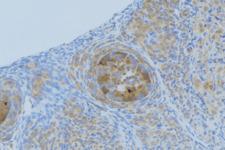 CXCL1 / GRO Alpha Antibody - 1:100 staining human uterus tissue by IHC-P. The sample was formaldehyde fixed and a heat mediated antigen retrieval step in citrate buffer was performed. The sample was then blocked and incubated with the antibody for 1.5 hours at 22°C. An HRP conjugated goat anti-rabbit antibody was used as the secondary.