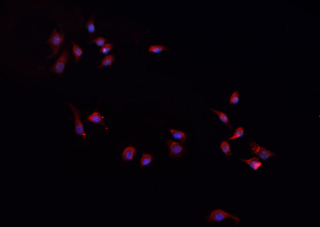 CXCL1 / GRO Alpha Antibody - Staining A431 cells by IF/ICC. The samples were fixed with PFA and permeabilized in 0.1% Triton X-100, then blocked in 10% serum for 45 min at 25°C. The primary antibody was diluted at 1:200 and incubated with the sample for 1 hour at 37°C. An Alexa Fluor 594 conjugated goat anti-rabbit IgG (H+L) antibody, diluted at 1/600, was used as secondary antibody.