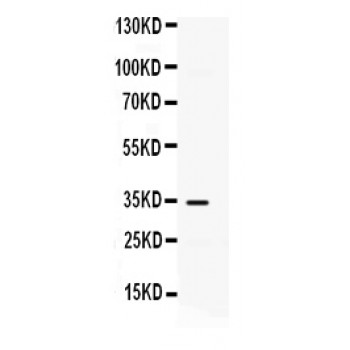 CXCL10 / IP-10 Antibody - IP10 antibody Western blot. All lanes: Anti IP10 at 0.5 ug/ml. WB: HELA Whole Cell Lysate at 40 ug. Predicted band size: 34 kD. Observed band size: 34 kD.