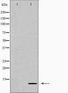 CXCL10 / IP-10 Antibody - Western blot analysis of extracts of HeLa cells using CXCL10 antibody. The lane on the left is treated with the antigen-specific peptide.