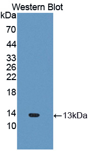 CXCL11 Antibody - Western blot of CXCL11 antibody.